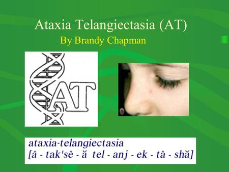 Ataxia Telangiectasia (AT) By Brandy Chapman. Characteristics of Ataxia- telangiectasia: Progressive neuronal degeneration Loss of cerebellar function.