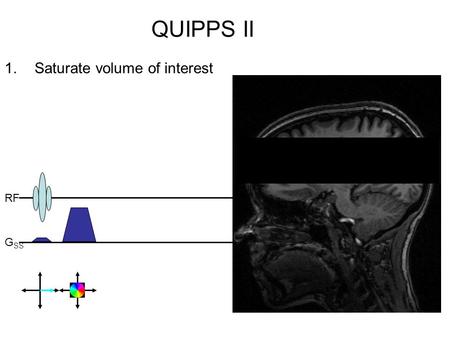 QUIPPS II 1.Saturate volume of interest RF G SS. QUIPPS II 1.Saturate volume of interest 2.Tag (invert) incoming blood RF G SS.