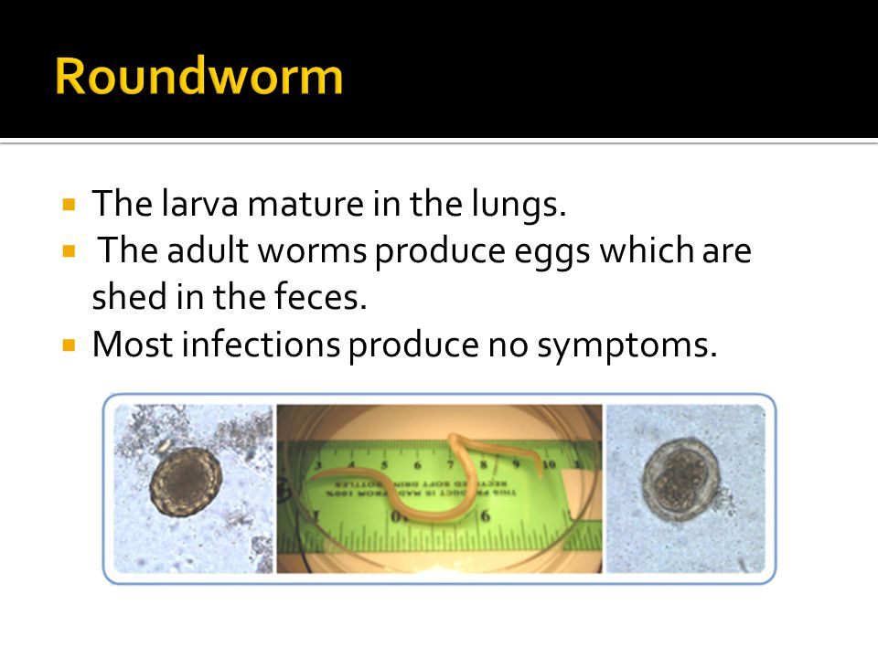 Roundworm In Adults 37