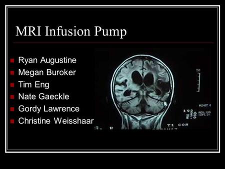 MRI Infusion Pump Ryan Augustine Megan Buroker Tim Eng Nate Gaeckle