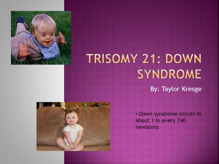 By: Taylor Kresge Down syndrome occurs in about 1 in every 740 newborns.