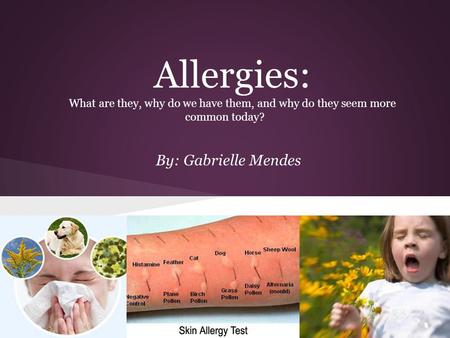 Allergies: What are they, why do we have them, and why do they seem more common today? By: Gabrielle Mendes.
