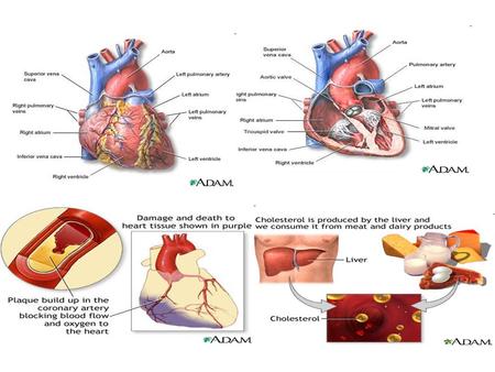 Coronary heart disease (CHD) is the leading cause of death