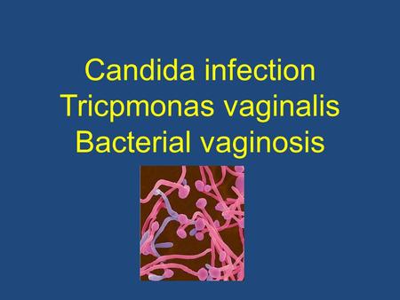 Candida infection Tricpmonas vaginalis Bacterial vaginosis
