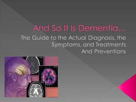  “Dementia isn’t a specific disease. Instead, dementia describes a group of symptoms affecting memory, thinking and social abilities severely enough.