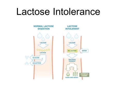 Lactose Intolerance. Milk and other dairy products contain a sugar or carbohydrate called lactose. Normally, the body breaks down lactose into its simpler.