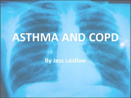 ASTHMA AND COPD By Jess Laidlaw. Overview 1)Asthma 2)COPD 3)Comparison.