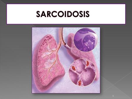 1. 2  Sarcoidosis term is formed from - sarc meaning flesh, - oid meaning like, and - osis for diseased or abnormal condition.  It is also called sarcoid,