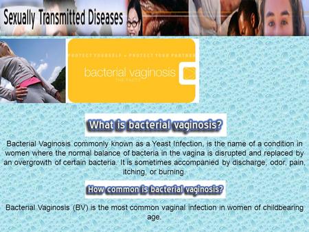 Bacterial Vaginosis (BV) is the name of a condition in women where the normal balance of bacteria in the vagina is disrupted and replaced by an overgrowth.