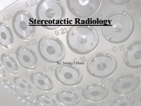 Stereotactic RadiologyStereotactic Radiology By: Jeremy Lishner.