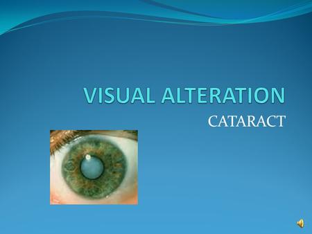 CATARACT ASSESSMENT Cataract: opacity of the lens Population at risk: greater than 70 years old S&S: blurred vision.