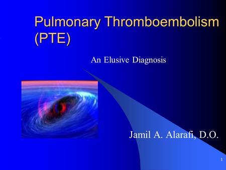 1 Pulmonary Thromboembolism (PTE) Jamil A. Alarafi, D.O. An Elusive Diagnosis.