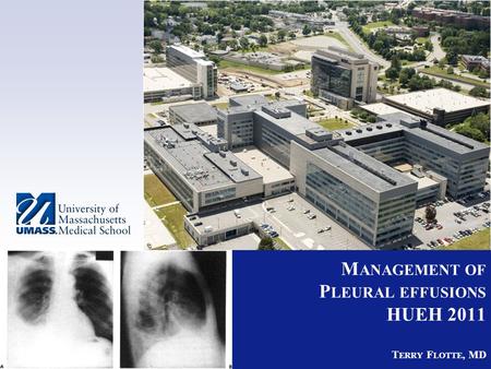 Management of Pleural effusions HUEH 2011 Terry Flotte, MD