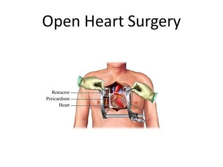 Open Heart Surgery. Most Common Types Coronary Artery Bypass Graft (CABG) Heart Valve Procedures Heart Transplant Thoracic Aortic Aorta Procedures.