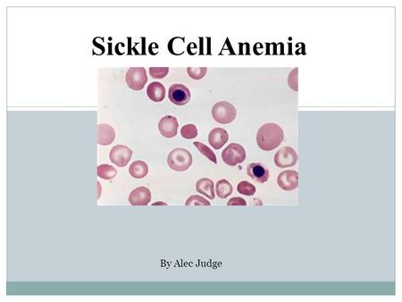Sickle Cell Anemia By Alec Judge. What is it? Sickle cell anemia is caused by a mutation in the gene that tells your body to make hemoglobin, the red,