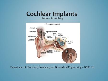 Cochlear Implants Andrew Rosenberg