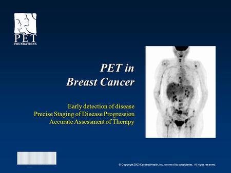 © Copyright 2003 Cardinal Health, Inc. or one of its subsidiaries. All rights reserved. PET in Breast Cancer Early detection of disease Precise Staging.