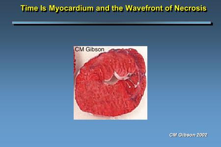 Time Is Myocardium and the Wavefront of Necrosis CM Gibson 2002.