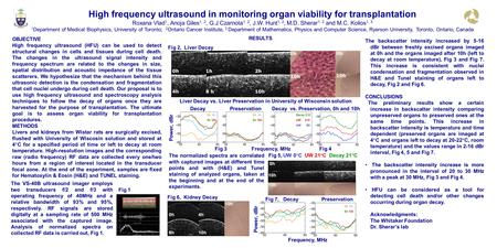 High frequency ultrasound in monitoring organ viability for transplantation Roxana Vlad 1, Anoja Giles 1, 2, G.J Czarnota 1, 2, J.W. Hunt 1, 2, M.D. Sherar.