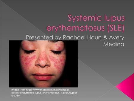 Image From  collection/systemic_lupus_erythematosus_1_picture/pict ure.htm.