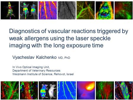 Diagnostics of vascular reactions triggered by weak allergens using the laser speckle imaging with the long exposure time Vyacheslav Kalchenko MD, PhD.