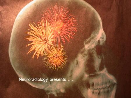 Neuroradiology presents…... Cerebrovascular Disease David M. Pelz, MD, FRCPC Neuroradiology, LHSC.