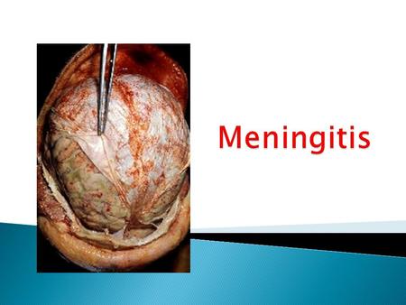 Students should  Specify microorganisms causing meningitis  Delineate the therapeutic strategy  Classify the relevant antibiotics used  Expand on.