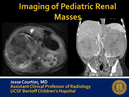 Imaging of Pediatric Renal Masses