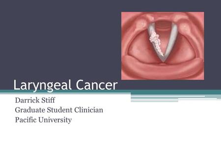 Laryngeal Cancer Darrick Stiff Graduate Student Clinician Pacific University.