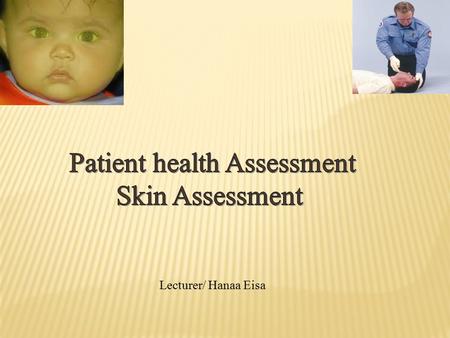 Learning out come Implementation AssessmentNormal Finding Deviations from Normal Pallor, cyanosis, Jaundice, erythema.