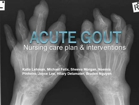 Nursing care plan & interventions