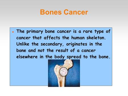 Bones Cancer The primary bone cancer is a rare type of cancer that affects the human skeleton. Unlike the secondary, originates in the bone and not the.
