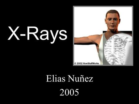 X-Rays Elias Nuñez 2005.