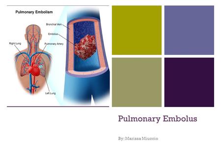 + Pulmonary Embolus By: Marissa Miuccio. + What is a Pulmonary Embolism Pulmonary Embolism, or PE, is a sudden blockage in a lung artery. The blockage.