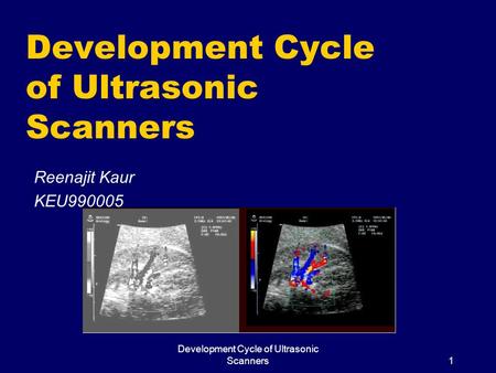 Development Cycle of Ultrasonic Scanners1 Reenajit Kaur KEU990005.
