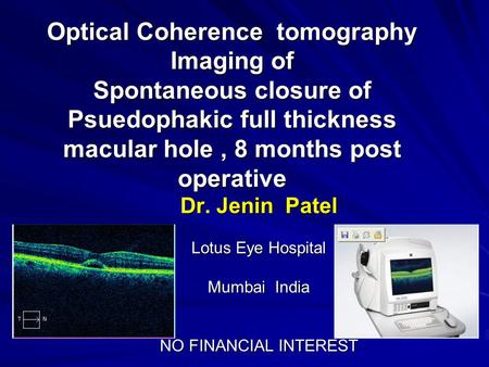 Optical Coherence tomography Imaging of Spontaneous closure of Psuedophakic full thickness macular hole, 8 months post operative Dr. Jenin Patel Lotus.