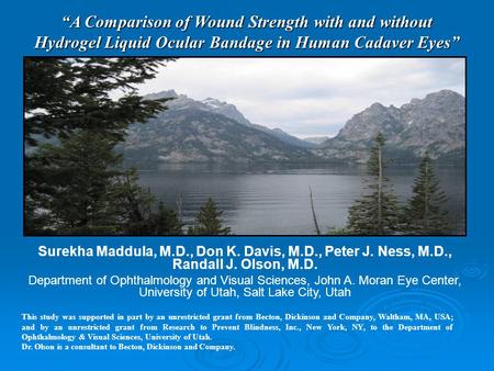 “A Comparison of Wound Strength with and without Hydrogel Liquid Ocular Bandage in Human Cadaver Eyes” This study was supported in part by an unrestricted.