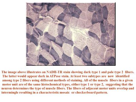 The image above illustrates an NADH-TR stain showing dark type 1 and pale type 2 fibers. The latter would appear dark in ATPase stain. At least two subtypes.