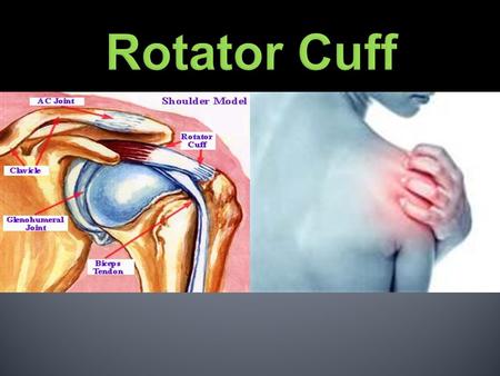 Rotator Cuff Injuries.