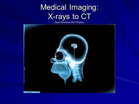 Medical Imaging: X-rays to CT Zach Simmons UST Physics.