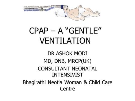 CPAP – A “GENTLE” VENTILATION DR ASHOK MODI MD, DNB, MRCP(UK) CONSULTANT NEONATAL INTENSIVIST Bhagirathi Neotia Woman & Child Care Centre.