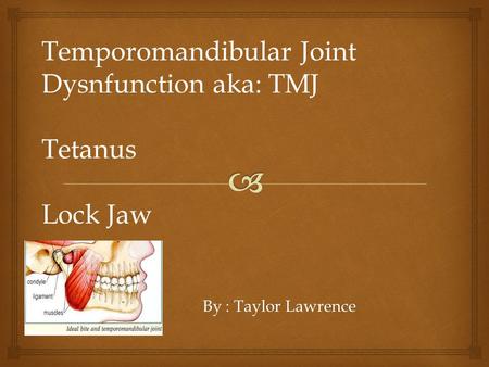 By : Taylor Lawrence Temporomandibular Joint Dysnfunction aka: TMJ Tetanus Lock Jaw.