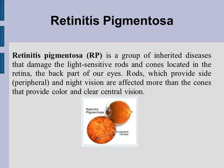Retinitis pigmentosa (RP) is a group of inherited diseases that damage the light-sensitive rods and cones located in the retina, the back part of our eyes.