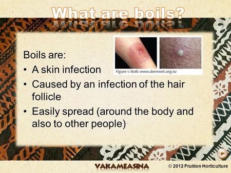 © 2012 Fruition Horticulture Boils are: A skin infection Caused by an infection of the hair follicle Easily spread (around the body and also to other.