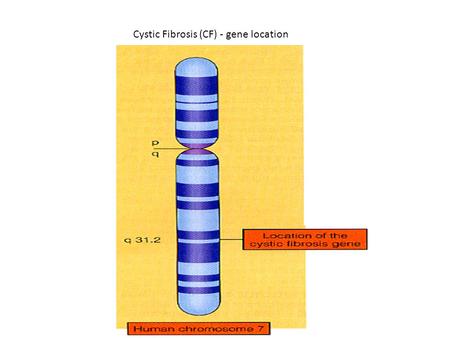Cystic Fibrosis (CF) - gene location. Cystic Fibrosis (CF): Molecular defect.