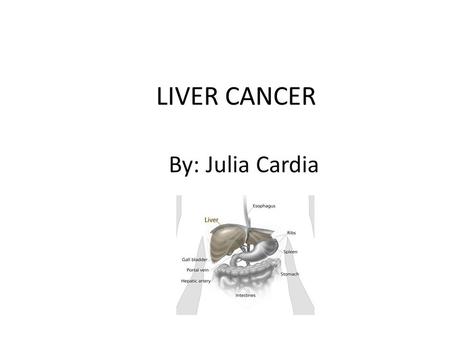 LIVER CANCER By: Julia Cardia. Causes Cancer is spread from another part of the body (usually colon, lung, breast) and goes to the liver…this is known.