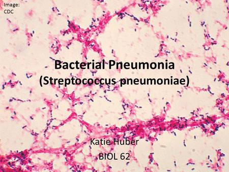 Bacterial Pneumonia (Streptococcus pneumoniae) Katie Huber BIOL 62 Image: CDC.