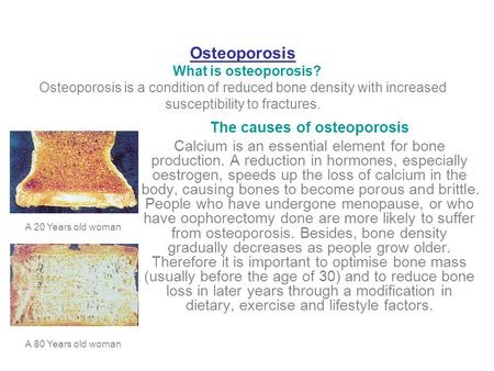 Osteoporosis What is osteoporosis? Osteoporosis is a condition of reduced bone density with increased susceptibility to fractures. The causes of osteoporosis.