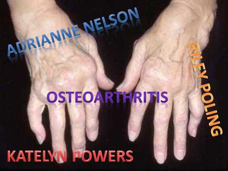 Called the wear and tear arthritis, osteoarthritis is the most common form of arthritis. Nearly all vertebrates suffer from osteoarthritis, including.