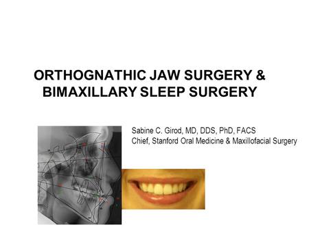 ORTHOGNATHIC JAW SURGERY & BIMAXILLARY SLEEP SURGERY Sabine C. Girod, MD, DDS, PhD, FACS Chief, Stanford Oral Medicine & Maxillofacial Surgery.